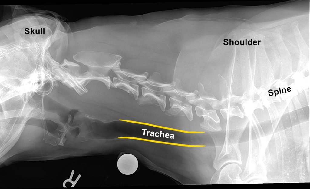 Tracheal Collapse Medical Management Versus Implantable Stents