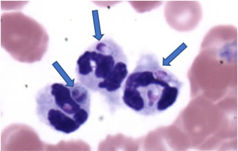 Figure 6: H. capsulatum (as indicated by arrows) inside of white blood cells; Image: Dr Hoffman MU VHC Comparative Medicine