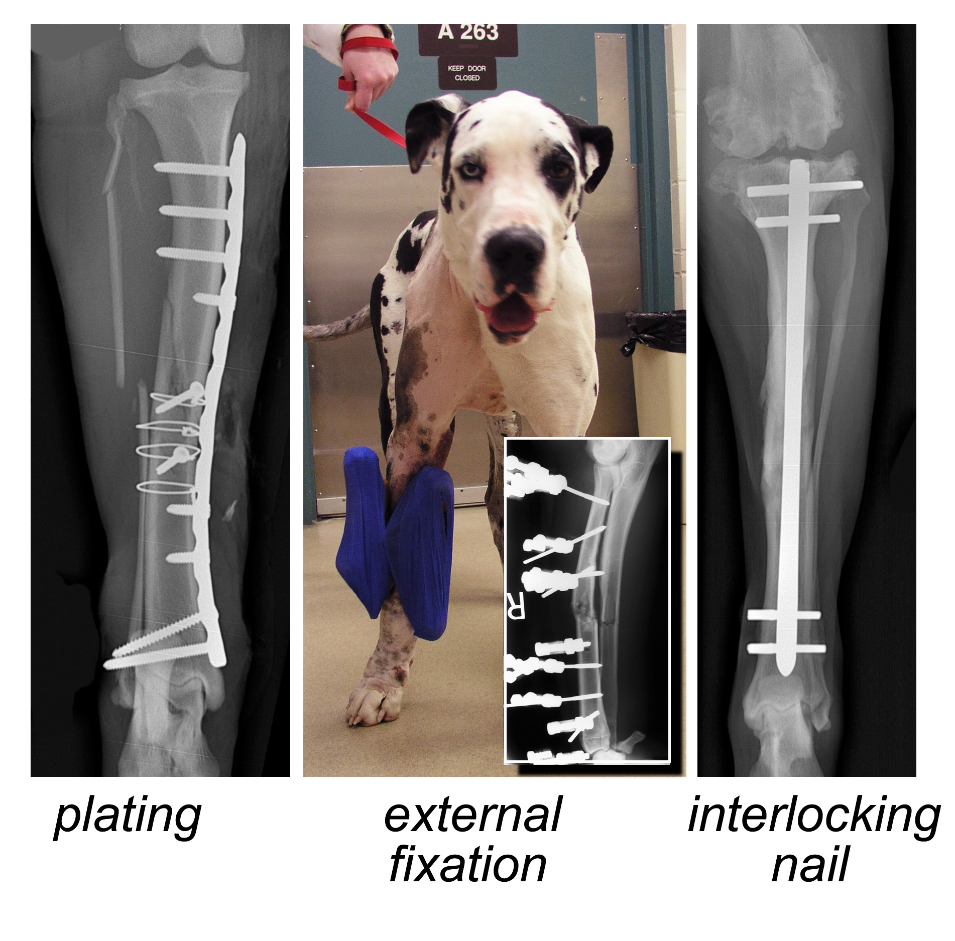 Applied Sciences | Free Full-Text | Finite Element Analysis of Traditional  and New Fixation Techniques of the 3D-Printed Composite Interlocking Nail  in Canine Femoral Shaft Fractures