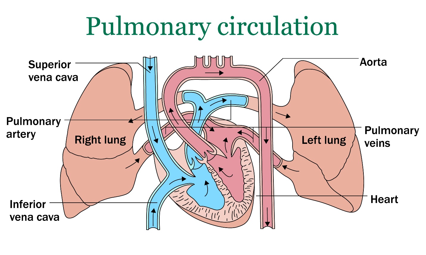 pulmonary-hypertension-explained-by-a-cardiologist-myheart