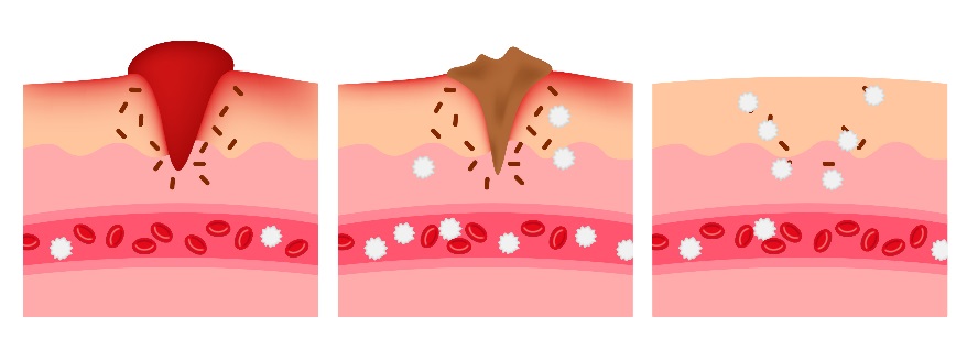 what would cause a dogs blood platelets to be low