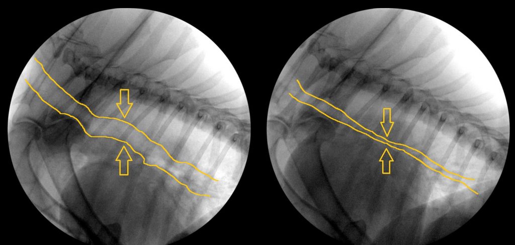 One of the respiratory conditions that can cause pulmonary hypertension is tracheal collapse, where the dog’s windpipe becomes narrow and leads to coughing and breathing issues. In these fluoroscopic images, the normal diameter of the trachea is seen on inspiration (left) and nearly collapses on exhalation (right).